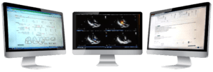 monitors displaying studycast medical imaging software