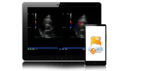 mobile ultrasound pacs image on tablet and mobile