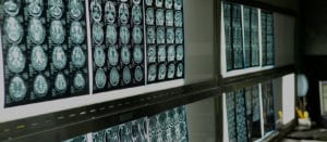 advanced medical images of head