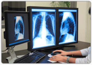 advanced medical imaging of chest on desktop