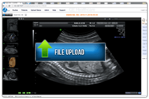 file upload for advanced medical imaging