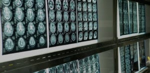 sheets of medical images printed out