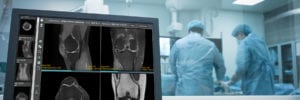 knee image from pacs imaging software