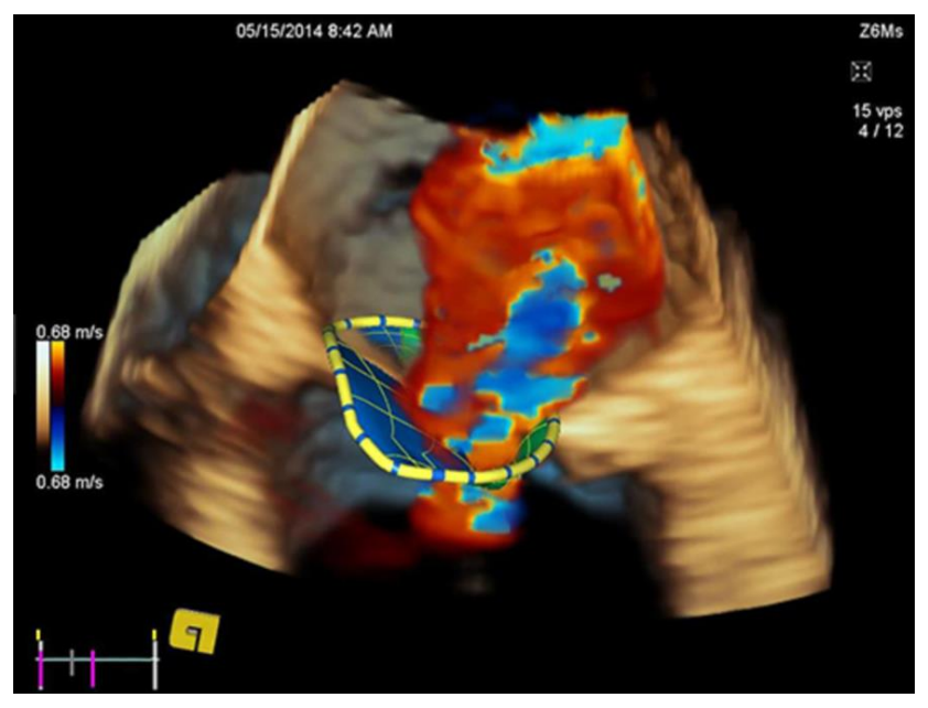 Studycast® Advisor™ – Simplifying Ultrasound Reporting – Putting Guidelines at your Fingertips