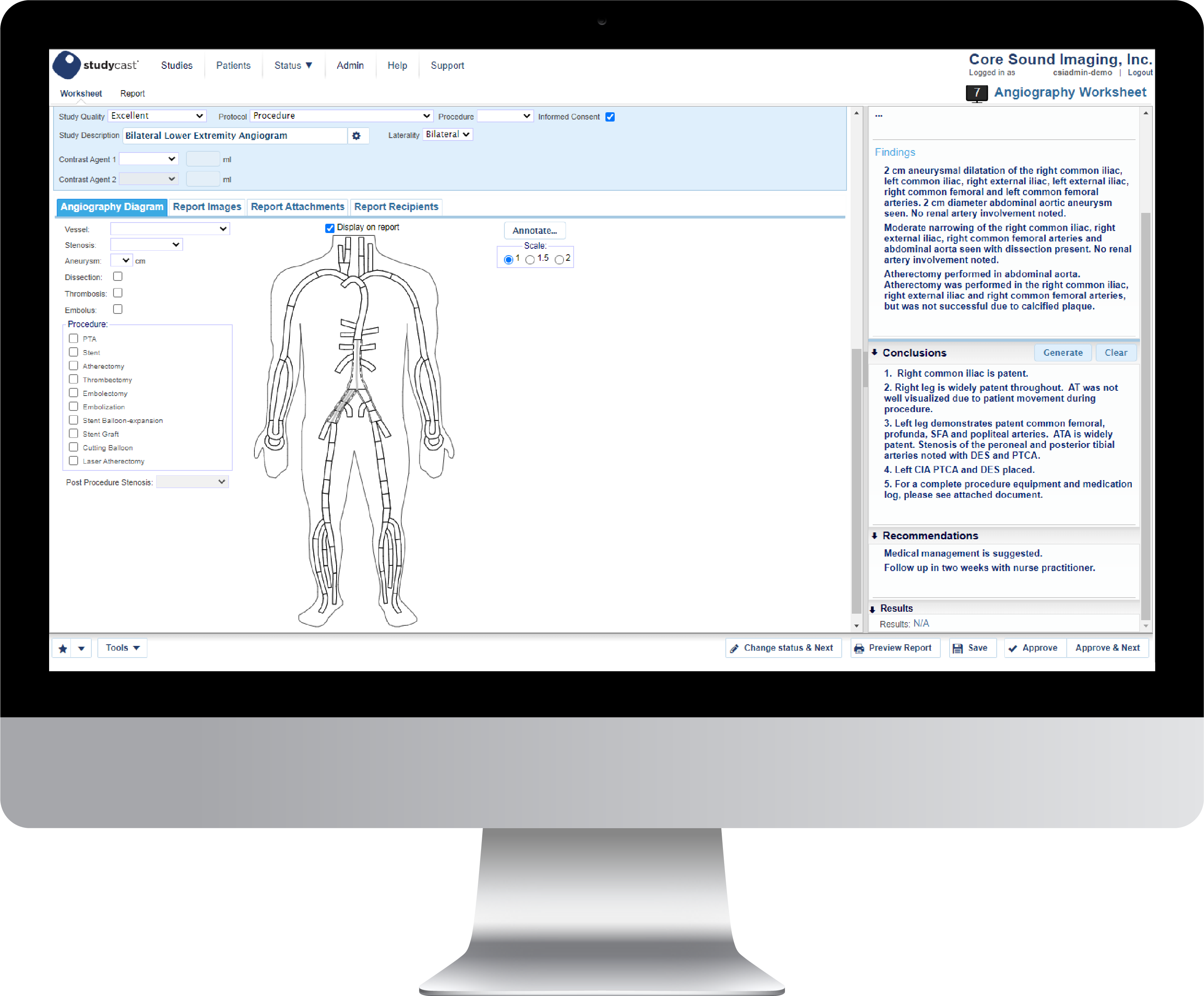 Studycast Angiography worksheet shown on a desktop monitor