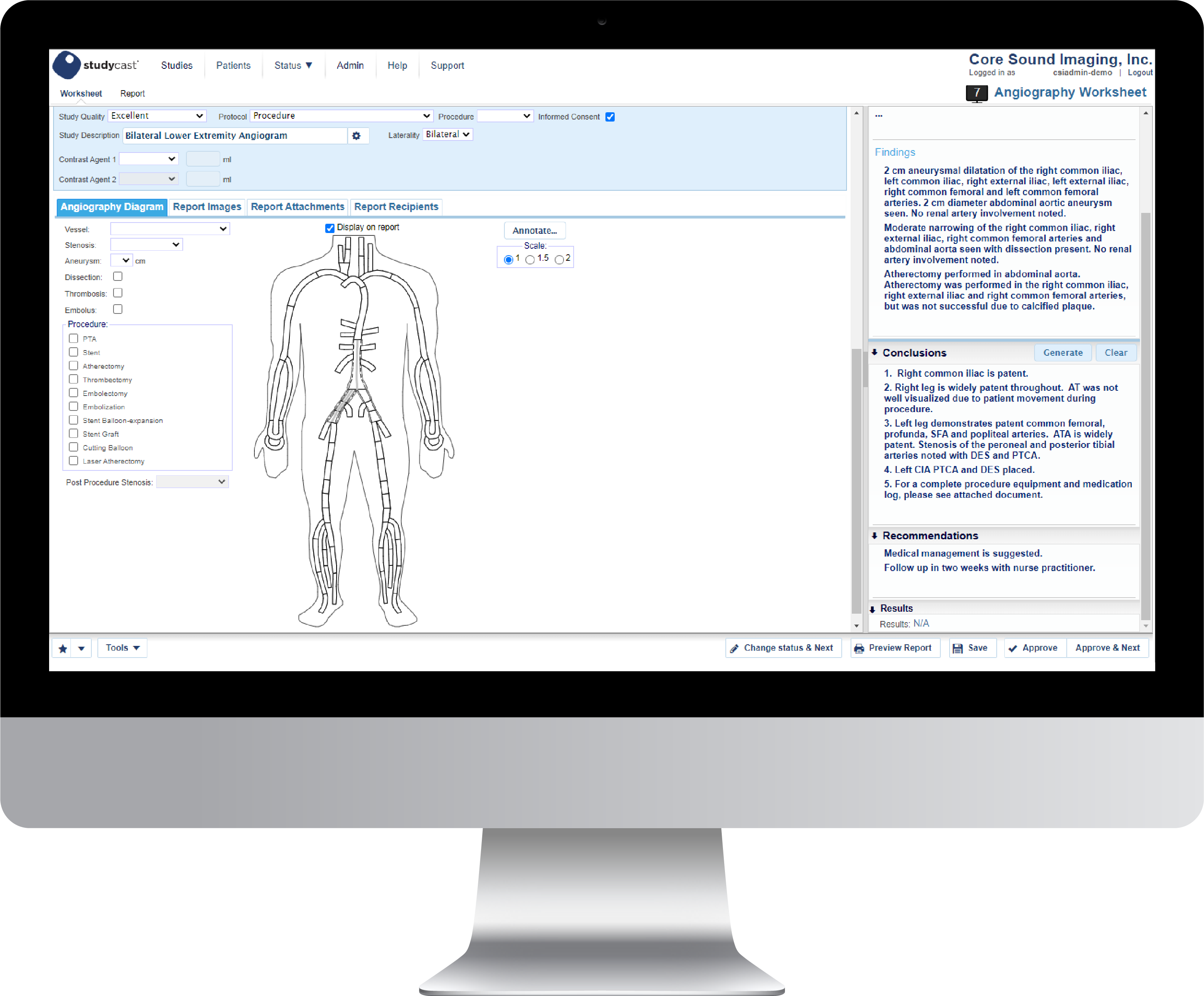 Studycast-angio-desktop | Core Sound Imaging, Inc. Studycast Angiography worksheet shown on a desktop monitor